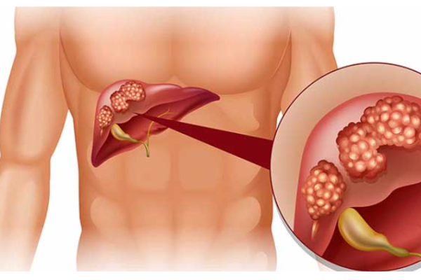 The Importance of Liver Function Tests for Optimal Health