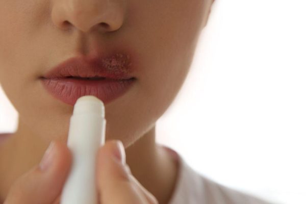 Unveiling the Secret of The Ultimate Lip Balm for Dark Lips