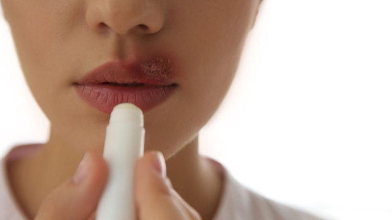 Unveiling the Secret of The Ultimate Lip Balm for Dark Lips