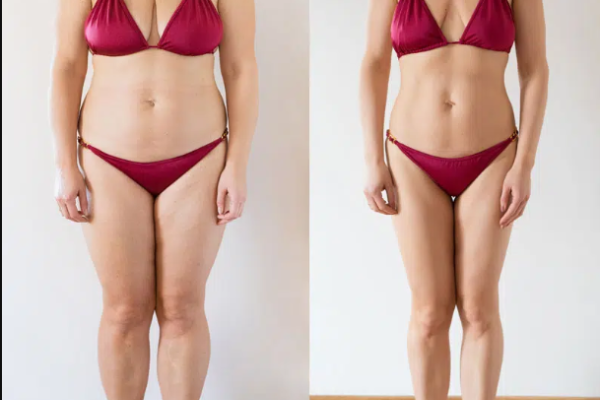 phentermine