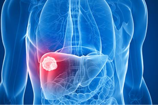 Awareness about the Symptoms, Causes, and Treatments